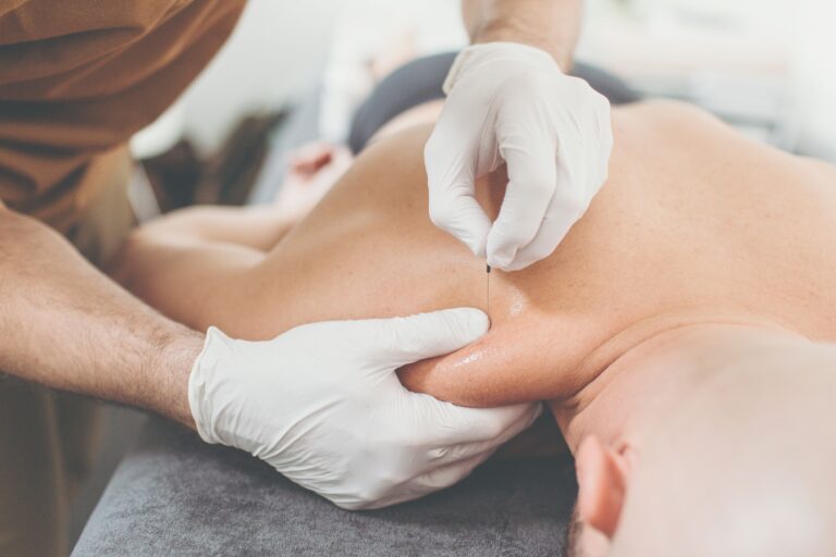 Dry Needling Effektive Schmerztherapie